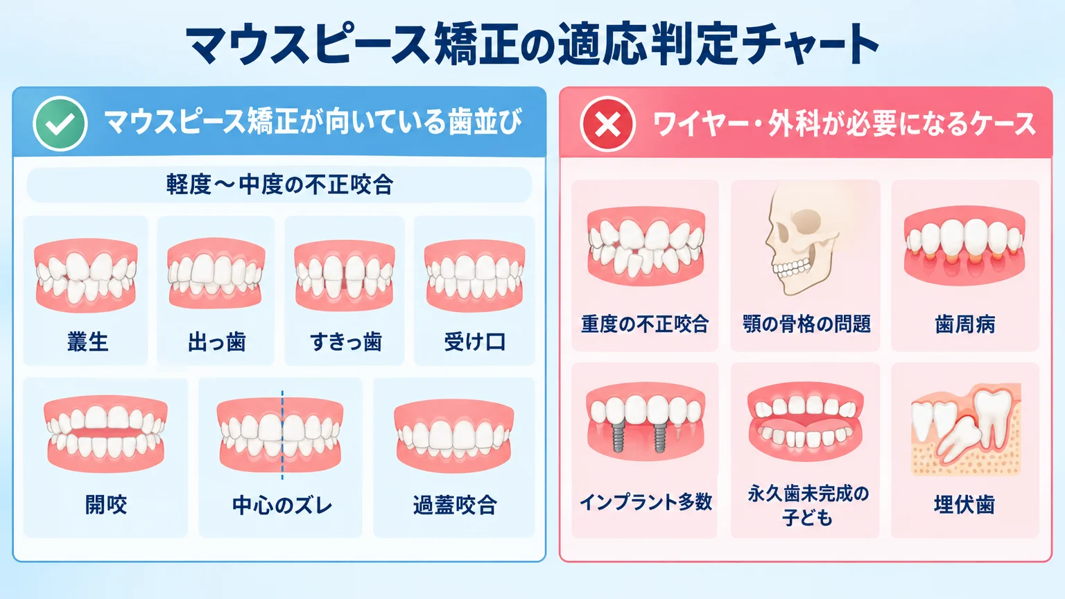 マウスピース矯正の適応判定チャート。向いている歯並び(軽度〜中度:叢生・出っ歯・すきっ歯・受け口・開咬・中心のズレ・過蓋咬合)と、ワイヤー・外科が必要になるケース(重度の不正咬合・顎の骨格の問題・歯周病・インプラント多数・永久歯未完成の子ども・埋伏歯)を左右に対比した早見図