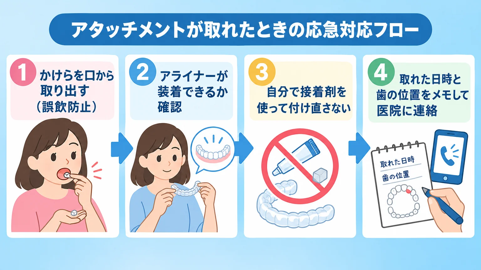 アタッチメントが取れたときの応急対応フローのイラスト。ステップ1『かけらを口から取り出す(誤飲防止)』→ステップ2『アライナーが装着できるか確認』→ステップ3『自分で接着剤を使って付け直さない』→ステップ4『取れた日時と歯の位置をメモして医院に連絡』の4ステップを矢印でつなぐフロー図