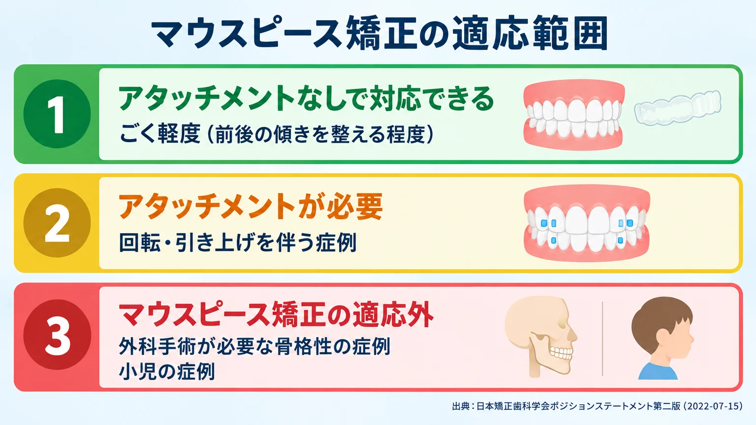 マウスピース矯正の適応範囲を示すインフォグラフィック。『アタッチメントなしで対応できる=ごく軽度(前後の傾きを整える程度)』『アタッチメントが必要=回転・引き上げを伴う症例』『マウスピース矯正の適応外=外科手術が必要な骨格性の症例/小児の症例』の3段階を信号機のような色分けで表示。出典:日本矯正歯科学会ポジションステートメント第二版(2022-07-15)