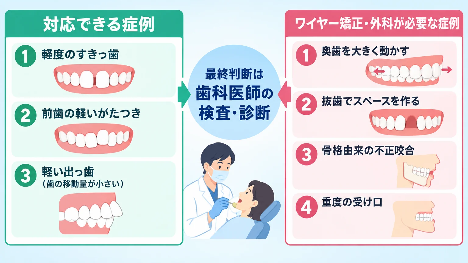 マウスピース矯正の適応境界線を示すイラスト図。左側『対応できる症例』＝軽度のすきっ歯・前歯の軽いがたつき・軽い出っ歯（歯の移動量が小さい）、右側『ワイヤー矯正・外科が必要な症例』＝奥歯を大きく動かす・抜歯でスペースを作る・骨格由来の不正咬合・重度の受け口。中央に『最終判断は歯科医師の検査・診断』と明記