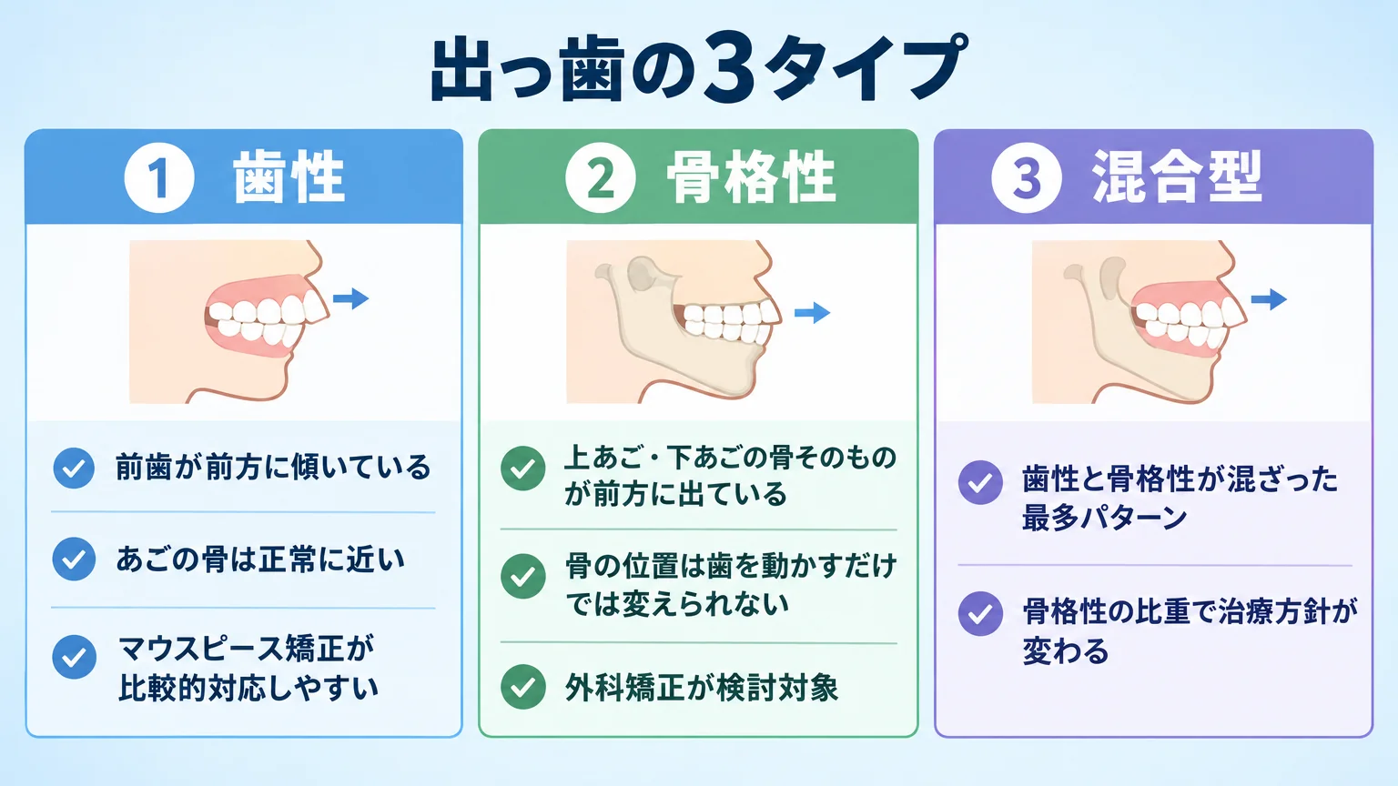 口ゴボの3タイプ分類インフォグラフィック。『歯性＝前歯が前方に傾いている／あごの骨は正常に近い／マウスピース矯正が比較的対応しやすい』『骨格性＝上あご・下あごの骨そのものが前方に出ている／骨の位置は歯を動かすだけでは変えられない／外科矯正が検討対象』『混合型＝歯性と骨格性が混ざった最多パターン／骨格性の比重で治療方針が変わる』を3列で対比表示