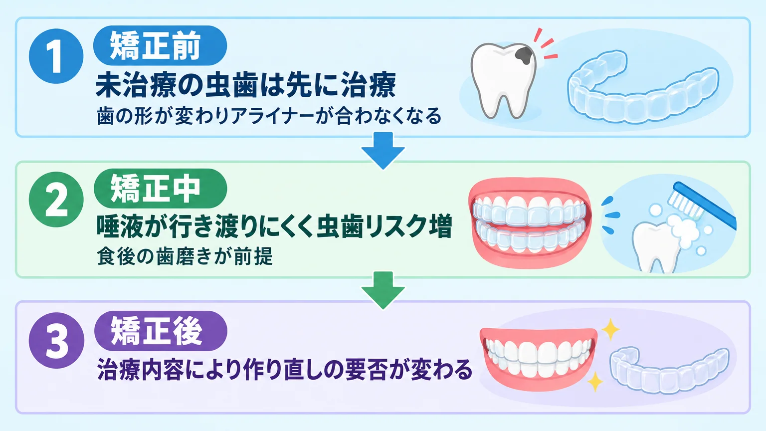 マウスピース矯正と虫歯の関係を段階ごとに整理したフロー図。縦3段で「矯正前：未治療の虫歯は先に治療（歯の形が変わりアライナーが合わなくなる）」→「矯正中：唾液が行き渡りにくく虫歯リスク増、食後の歯磨きが前提」→「矯正後：治療内容により作り直しの要否が変わる」を矢印でつなぐ。各段に歯とマウスピースのイラストを添える