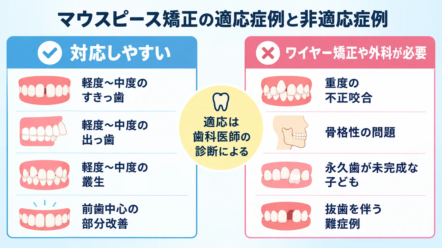 マウスピース矯正の適応症例と非適応症例を2列で比較した早見表。左列「対応しやすい（軽度〜中度のすきっ歯・出っ歯・叢生、前歯中心の部分改善）」右列「ワイヤー矯正や外科が必要（重度の不正咬合、骨格性の問題、永久歯が未完成な子ども、抜歯を伴う難症例）」。中央に「適応は歯科医師の診断による」と注記