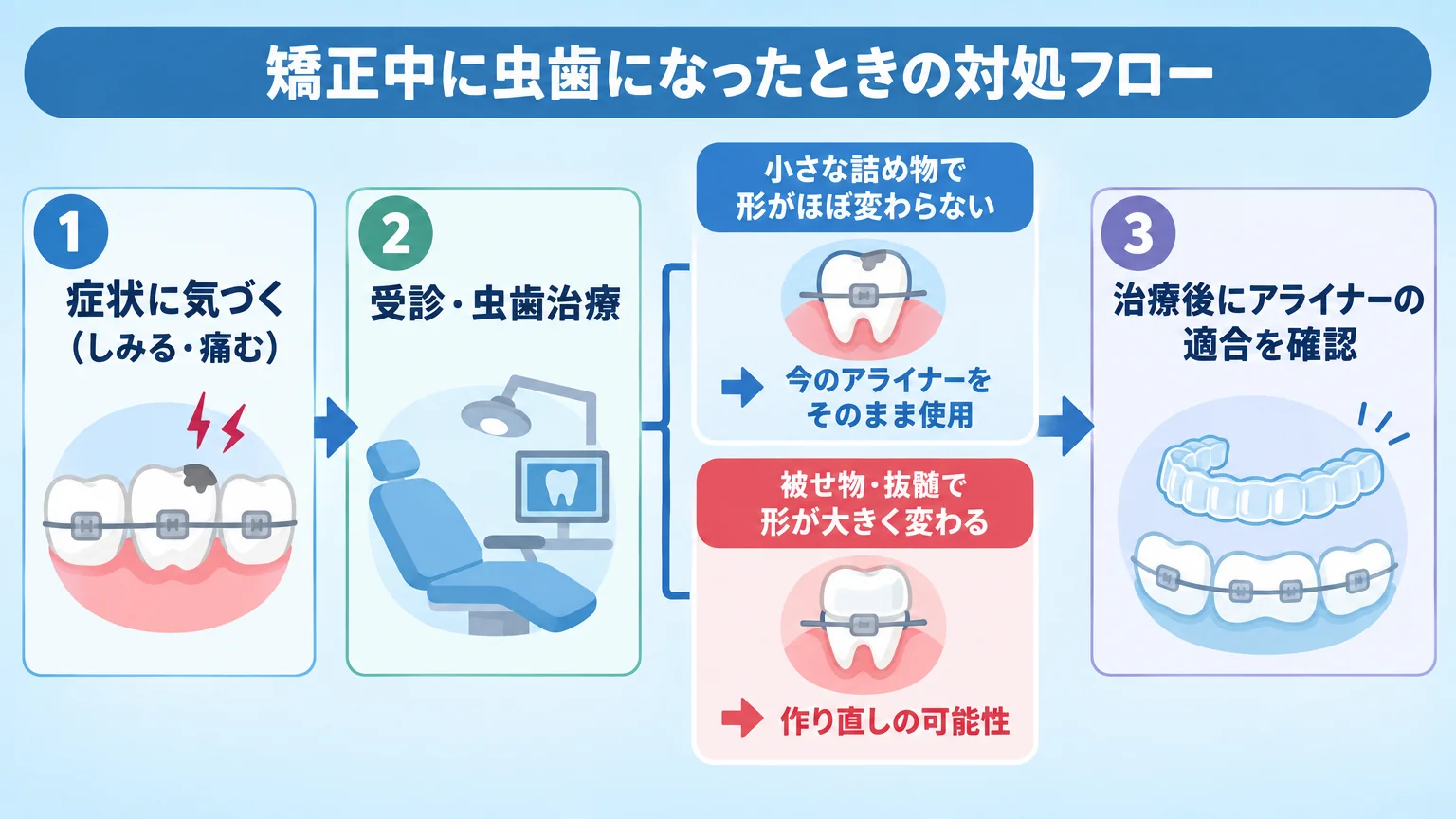 矯正中に虫歯になったときの対処フロー図。「症状に気づく（しみる・痛む）」→「受診・虫歯治療」→分岐「小さな詰め物で形がほぼ変わらない→今のアライナーをそのまま使用」「被せ物・抜髄で形が大きく変わる→作り直しの可能性」→「治療後にアライナーの適合を確認」。各ステップをアイコン付きで表示