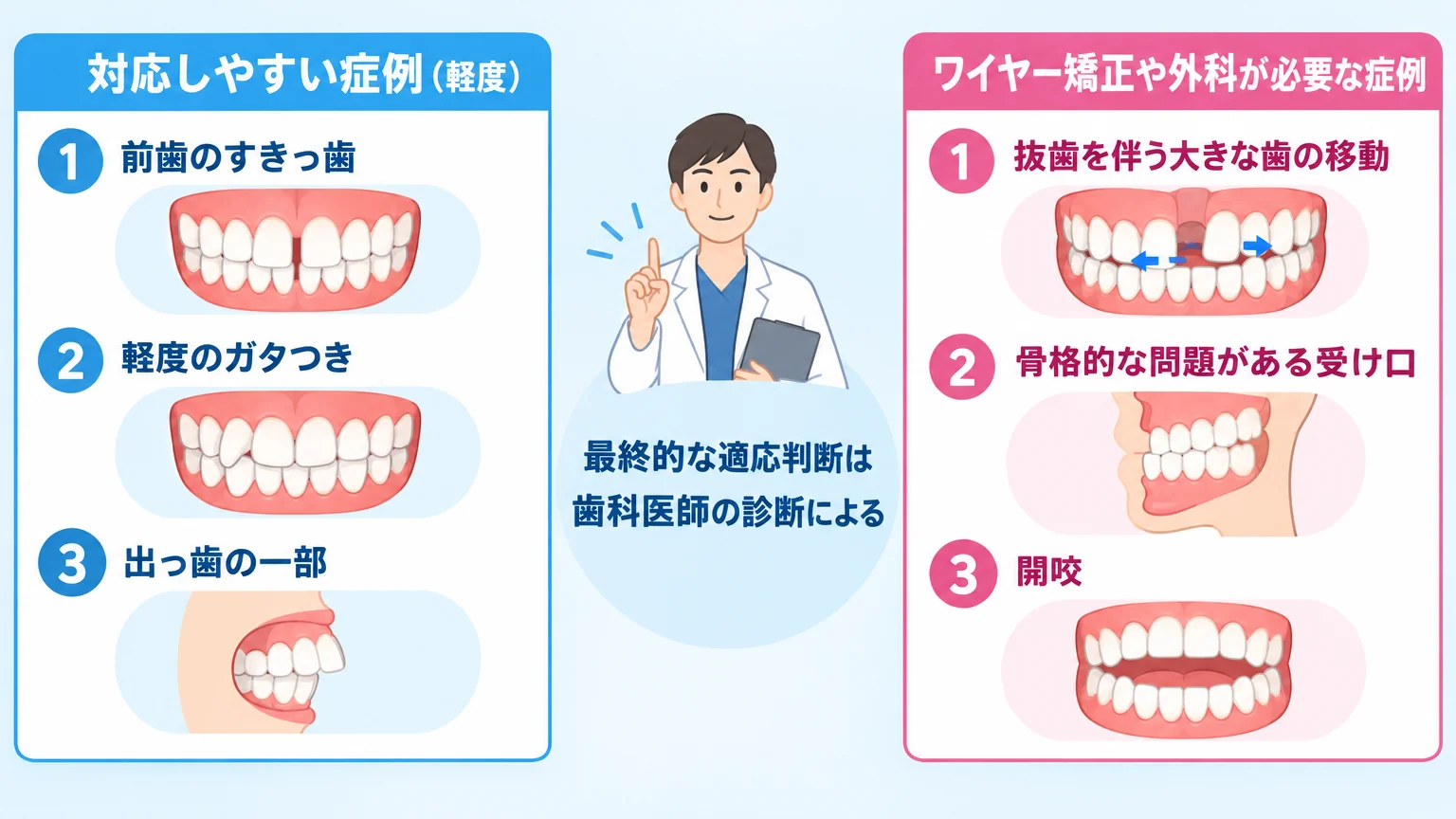 マウスピース矯正の適応範囲を示すイラスト。左側に「対応しやすい症例（軽度）」として前歯のすきっ歯・軽度のガタつき・出っ歯の一部のイラスト、右側に「ワイヤー矯正や外科が必要な症例」として抜歯を伴う大きな歯の移動・骨格的な問題がある受け口・開咬のイラスト。中央に「最終的な適応判断は歯科医師の診断による」と注記
