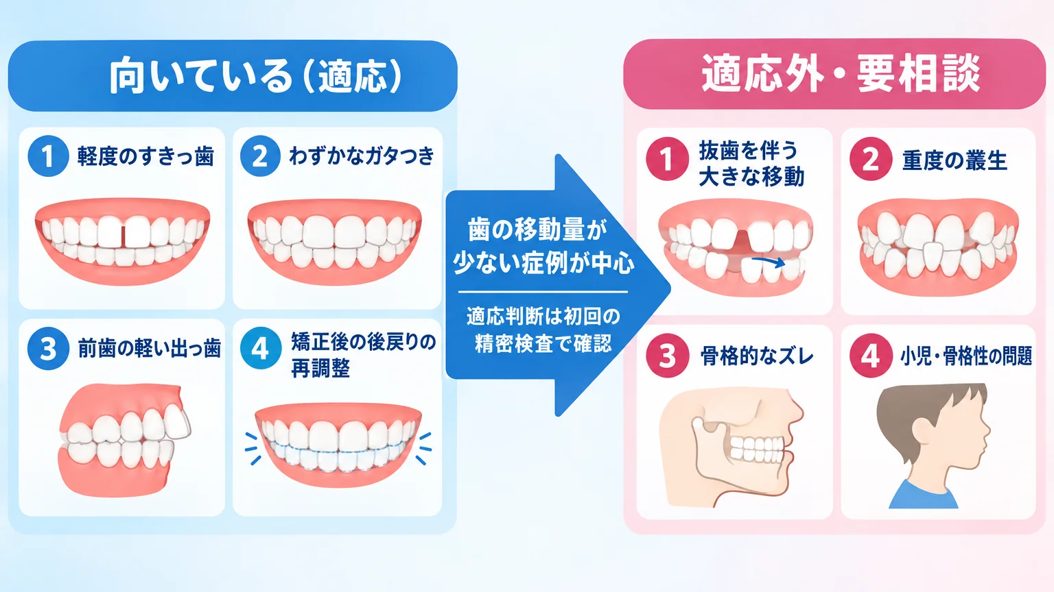 マウスピース矯正の適応と適応外を分けるイラスト図解。左側『向いている(適応)』に 軽度のすきっ歯、わずかなガタつき、前歯の軽い出っ歯、矯正後の後戻りの再調整。右側『適応外・要相談』に 抜歯を伴う大きな移動、重度の叢生、骨格的なズレ、小児・骨格性の問題。中央に『歯の移動量が少ない症例が中心/適応判断は初回の精密検査で確認』の矢印