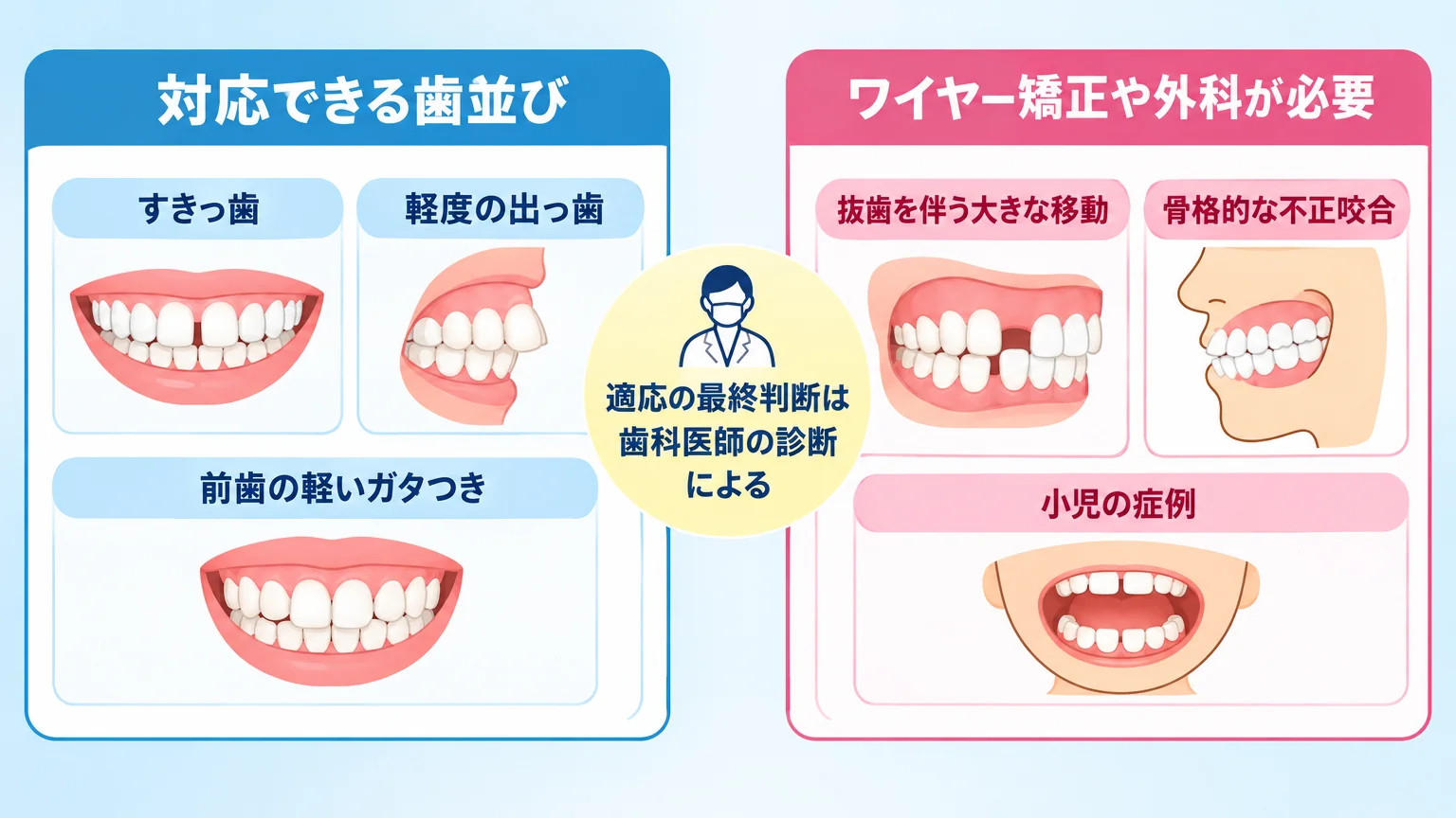 マウスピース矯正の適応・適応外を示すイラスト図。左側「対応できる歯並び」にすきっ歯・軽度の出っ歯・前歯の軽いガタつきをイラストで表示。右側「ワイヤー矯正や外科が必要」に抜歯を伴う大きな移動・骨格的な不正咬合・小児の症例を表示。中央に「適応の最終判断は歯科医師の診断による」の注記