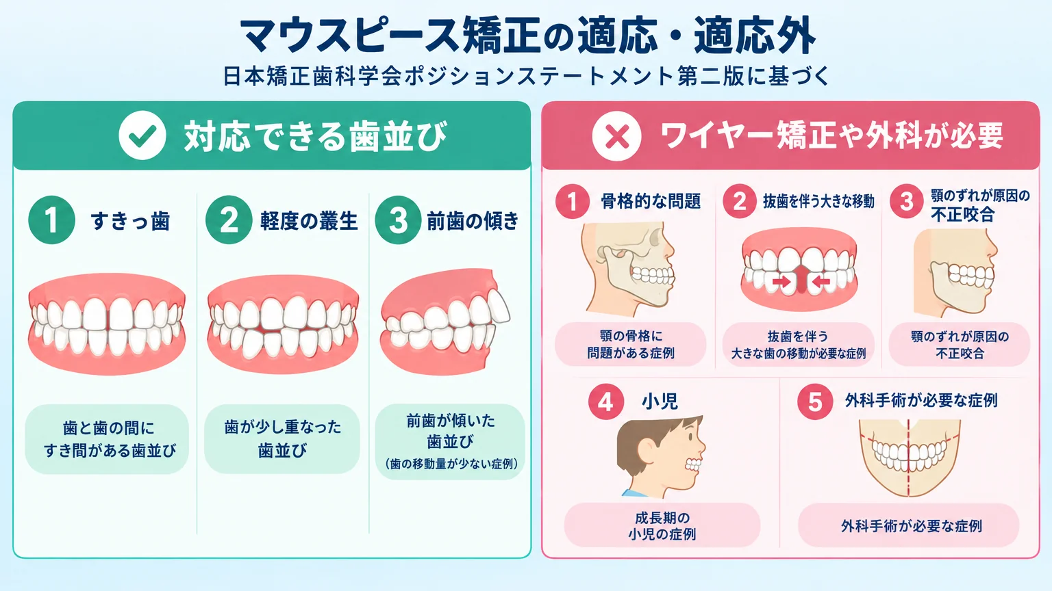 マウスピース矯正の適応・適応外を示す比較イラスト。「対応できる歯並び」=すきっ歯・軽度の叢生・前歯の傾き（歯の移動量が少ない症例）、「ワイヤー矯正や外科が必要」=骨格的な問題・抜歯を伴う大きな移動・顎のずれが原因の不正咬合・小児・外科手術が必要な症例。日本矯正歯科学会ポジションステートメント第二版に基づく2カラム比較