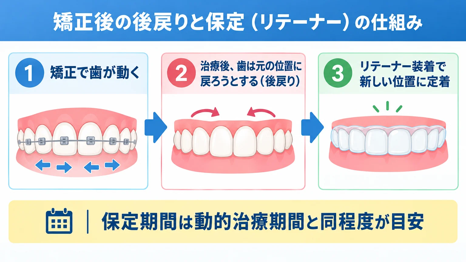 矯正後の後戻りと保定（リテーナー）の仕組みを示すフロー図。1.矯正で歯が動く→2.治療後、歯は元の位置に戻ろうとする（後戻り）→3.リテーナー装着で新しい位置に定着。保定期間は動的治療期間と同程度が目安という注記付き