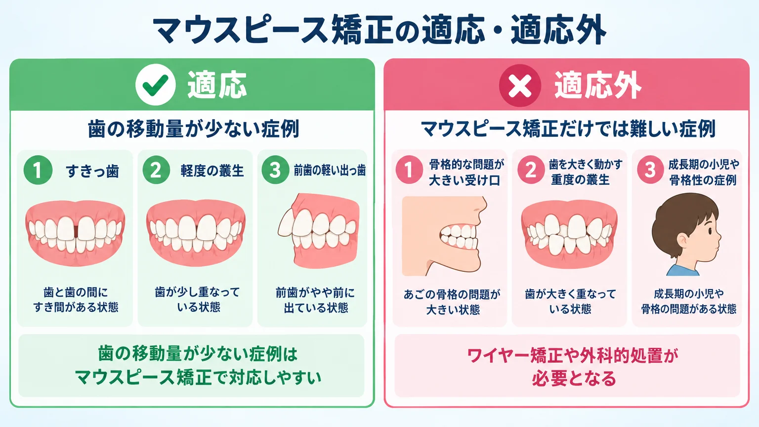 マウスピース矯正の適応・適応外を示すイラスト図。適応（すきっ歯・軽度の叢生・前歯の軽い出っ歯など歯の移動量が少ない症例）と適応外（骨格的な問題が大きい受け口・歯を大きく動かす重度の叢生・成長期の小児や骨格性の症例＝ワイヤー矯正や外科的処置が必要）を左右に対比したフロー図