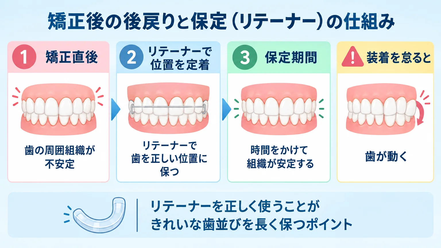 矯正後の後戻りと保定(リテーナー)の仕組みを説明するイラスト。矯正直後は歯の周囲組織が不安定→リテーナーで位置を定着→保定期間を経て安定、という3ステップのフロー図。装着を怠ると歯が動くという注意点も添える