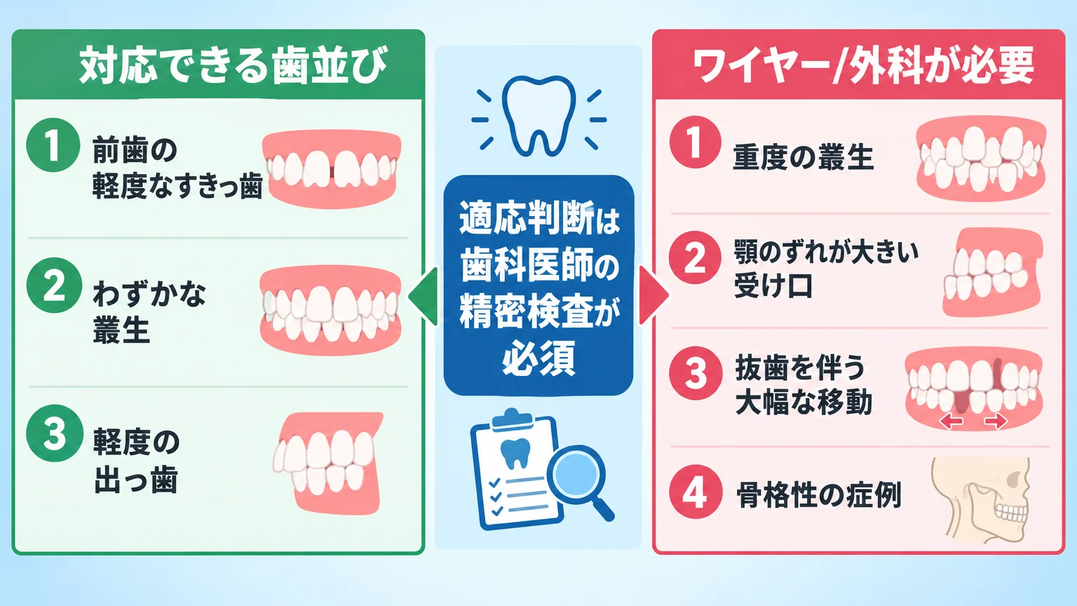 マウスピース矯正の適応・非適応を2列で比較するインフォグラフィック。左列『対応できる歯並び』=前歯の軽度なすきっ歯・わずかな叢生・軽度の出っ歯、右列『ワイヤー/外科が必要』=重度の叢生・顎のずれが大きい受け口・抜歯を伴う大幅な移動・骨格性の症例。中央に『適応判断は歯科医師の精密検査が必須』と明記