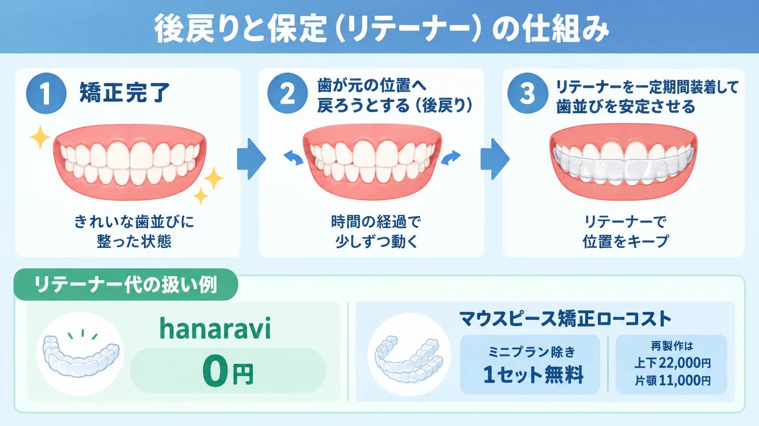 後戻りと保定(リテーナー)の仕組みを示すイラスト。『矯正完了→歯が元の位置へ戻ろうとする(後戻り)→リテーナーを一定期間装着して歯並びを安定させる』の3ステップフロー。リテーナー代の扱い例(hanaravi=0円、マウスピース矯正ローコスト=ミニプラン除き1セット無料・再製作は上下22,000円/片顎11,000円)を添える