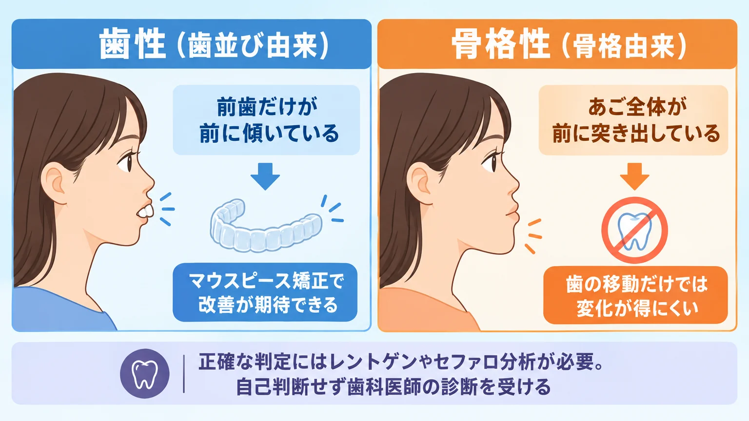 歯性と骨格性のセルフチェック比較イラスト。左『歯性(歯並び由来)』=前歯だけが前に傾いている横顔、マウスピース矯正で改善が期待できる。右『骨格性(骨格由来)』=あご全体が前に突き出している横顔、歯の移動だけでは変化が得にくい。下部に注記『正確な判定にはレントゲンやセファロ分析が必要。自己判断せず歯科医師の診断を受ける』