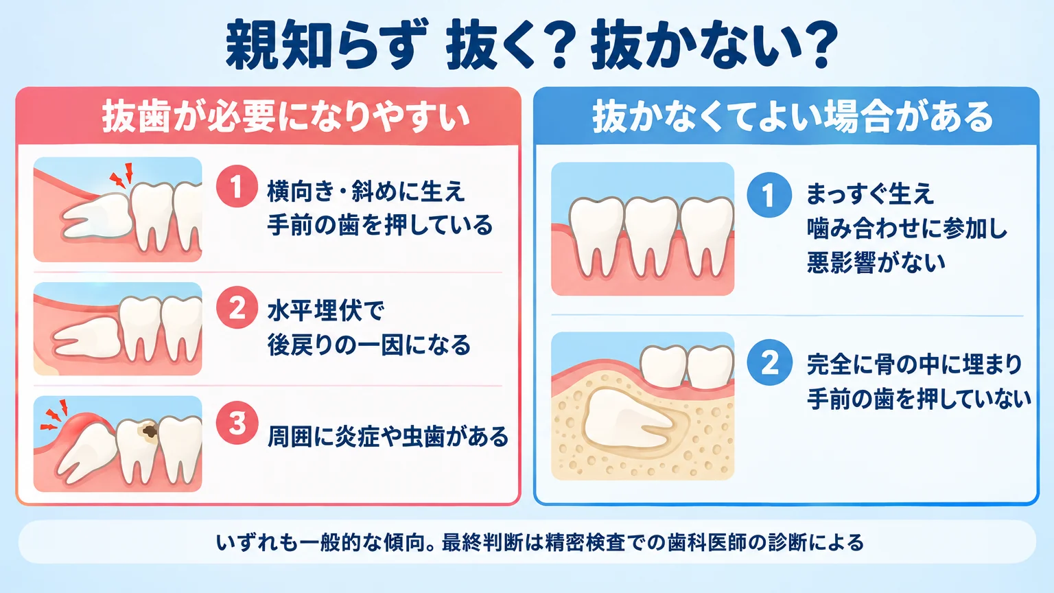 親知らずの抜歯要否を2列で比較するイラスト。左列『抜歯が必要になりやすい』=横向き・斜めに生え手前の歯を押している／水平埋伏で後戻りの一因になる／周囲に炎症や虫歯がある。右列『抜かなくてよい場合がある』=まっすぐ生え噛み合わせに参加し悪影響がない／完全に骨の中に埋まり手前の歯を押していない。下部に注記『いずれも一般的な傾向。最終判断は精密検査での歯科医師の診断による』。タイトル『親知らず 抜く？抜かない？』
