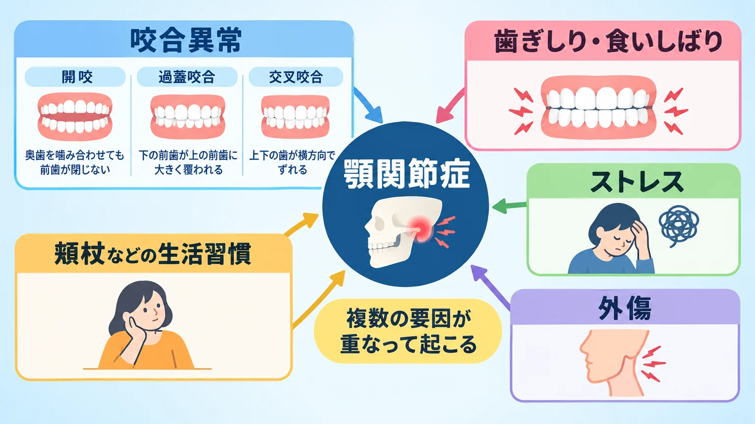 顎関節症の原因を示すインフォグラフィック。中央に『顎関節症』、周囲に要因を配置:咬合異常(開咬=奥歯を噛み合わせても前歯が閉じない/過蓋咬合=下の前歯が上の前歯に大きく覆われる/交叉咬合=上下の歯が横方向でずれる)、歯ぎしり・食いしばり、ストレス、外傷、頬杖などの生活習慣。『複数の要因が重なって起こる』と注記