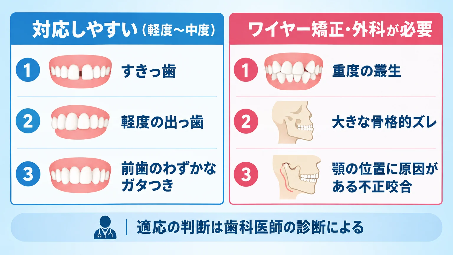 マウスピース矯正の適応・適応外を分けた一覧図。左列「対応しやすい（軽度〜中度）：すきっ歯／軽度の出っ歯／前歯のわずかなガタつき」、右列「ワイヤー矯正・外科が必要：重度の叢生／大きな骨格的ズレ／顎の位置に原因がある不正咬合」。下部に「適応の判断は歯科医師の診断による」の注記