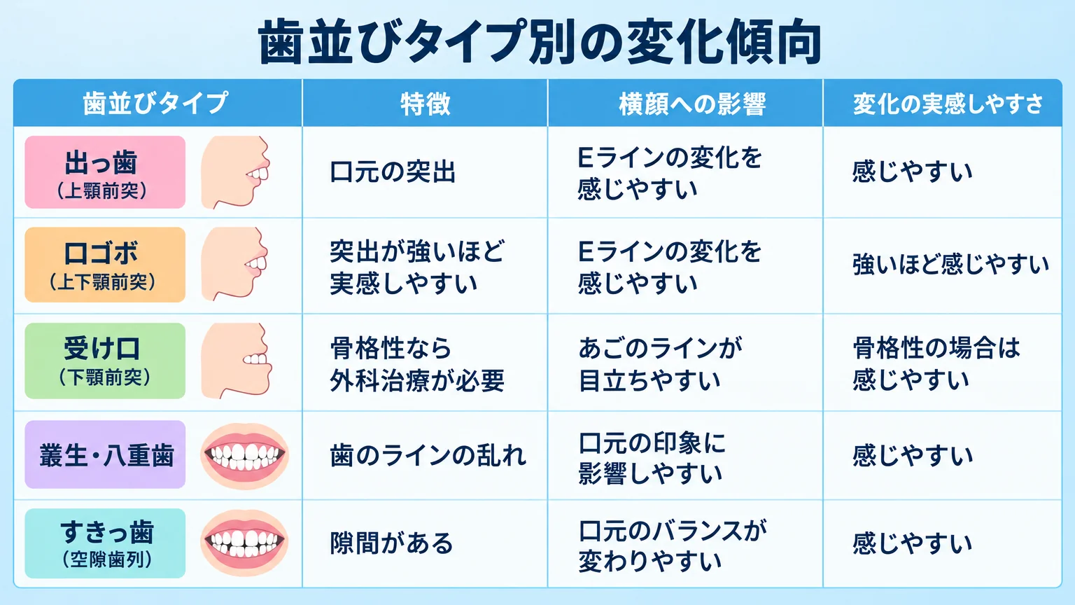歯並びタイプ別の変化傾向を示す比較表。行＝出っ歯（上顎前突）/口ゴボ（上下顎前突）/受け口（下顎前突）/叢生・八重歯/すきっ歯（空隙歯列）、列＝特徴・横顔への影響・変化の実感しやすさ。出っ歯＝口元突出・Eライン変化を感じやすい、口ゴボ＝突出が強いほど実感しやすい・抜歯を伴う場合あり、受け口＝骨格性なら外科治療が必要、叢生＝歯のラインの変化、すきっ歯＝隙間が閉じて印象が変わる