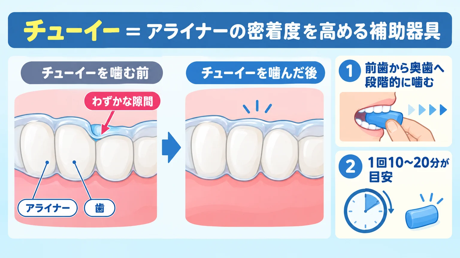 チューイーの役割を示すイラスト。マウスピース(アライナー)を装着した歯の断面図で、歯とアライナーの間にできた『わずかな隙間』を矢印で示し、チューイーを噛むことでその隙間が埋まりフィットする様子を前後比較で表現。テキストラベル『チューイー=アライナーの密着度を高める補助器具』『前歯から奥歯へ段階的に噛む』『1回10〜20分が目安』を含める