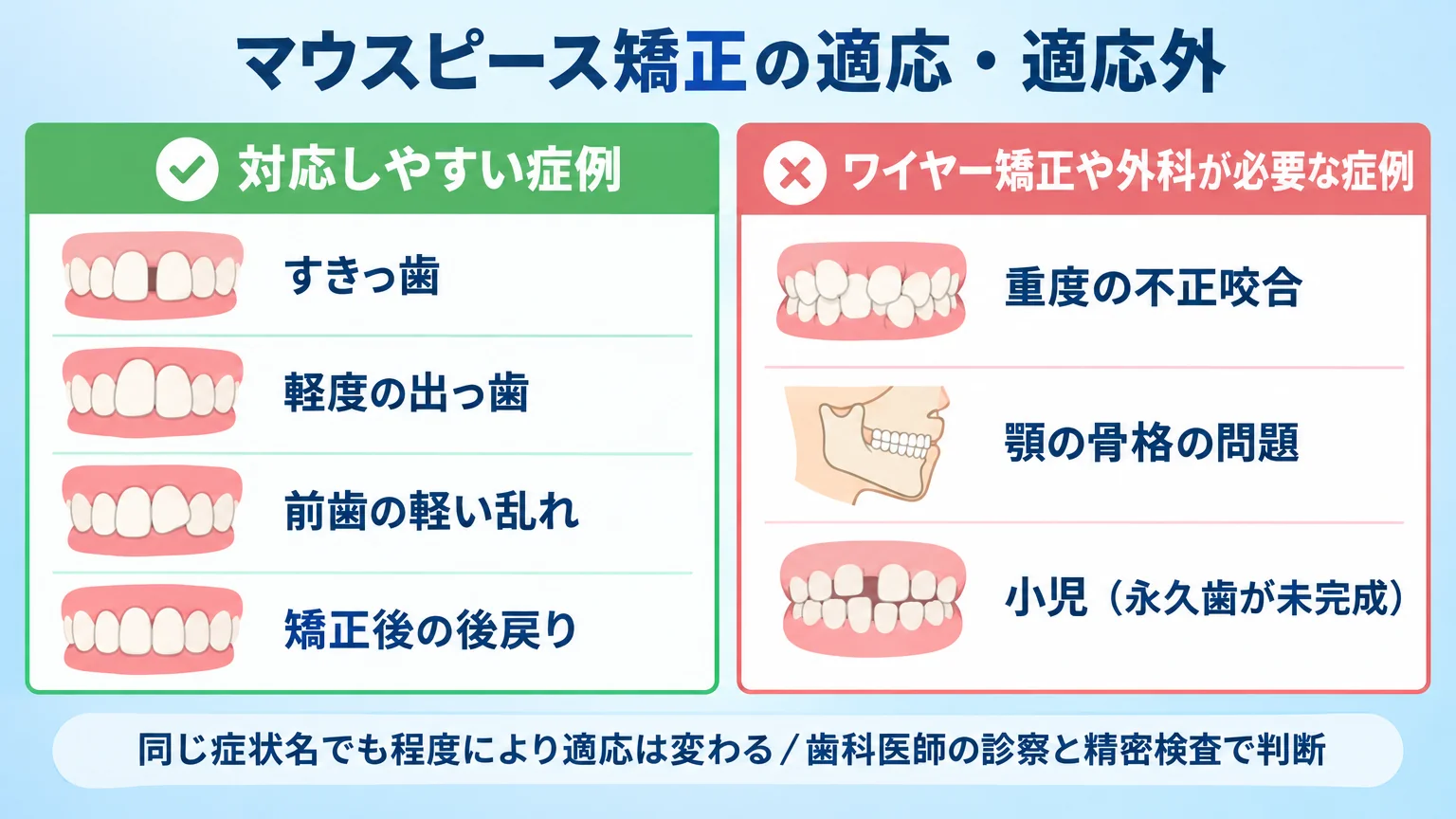 マウスピース矯正の適応・適応外を対比する表形式インフォグラフィック。左列『対応しやすい症例』にすきっ歯・軽度の出っ歯・前歯の軽い乱れ・矯正後の後戻り、右列『ワイヤー矯正や外科が必要な症例』に重度の不正咬合・顎の骨格の問題・小児(永久歯が未完成)を配置。下部に注記『同じ症状名でも程度により適応は変わる/歯科医師の診察と精密検査で判断』