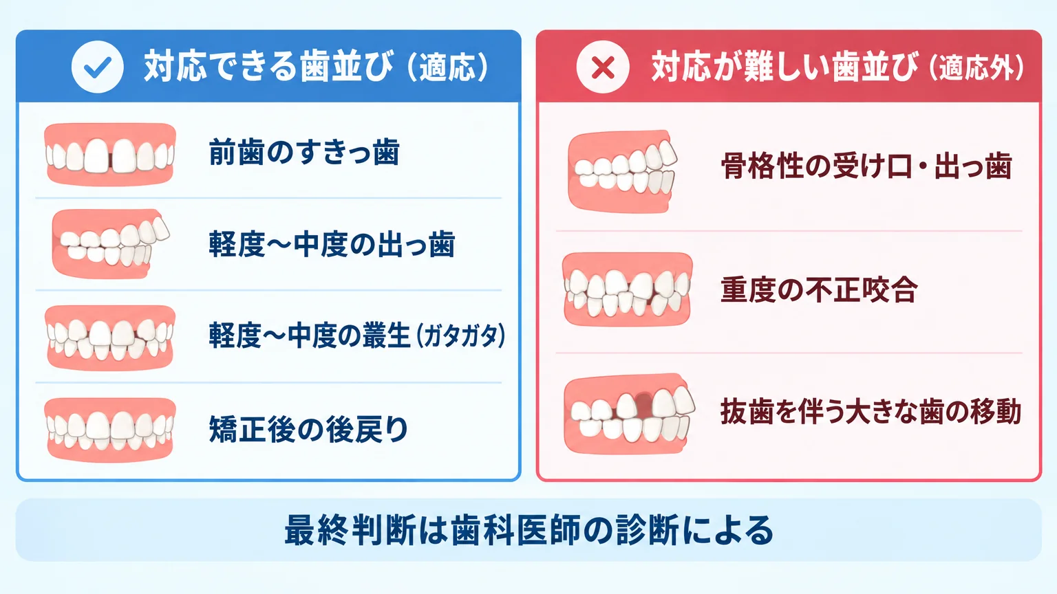 マウスピース矯正の適応・適応外を2カラムで対比した図表。左『対応できる歯並び（適応）』＝前歯のすきっ歯／軽度〜中度の出っ歯／軽度〜中度の叢生（ガタガタ）／矯正後の後戻り。右『対応が難しい歯並び（適応外）』＝骨格性の受け口・出っ歯／重度の不正咬合／抜歯を伴う大きな歯の移動。下部に『最終判断は歯科医師の診断による』のキャプション