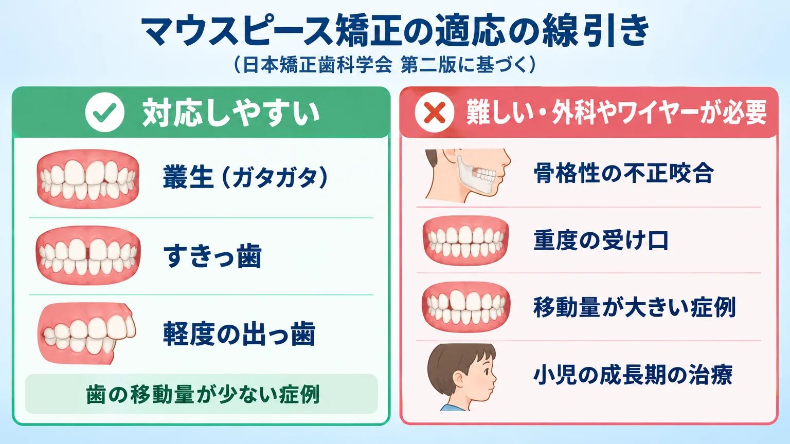 マウスピース矯正の適応症例と非適応症例を2列で整理したインフォグラフィック。左列『対応しやすい』叢生(ガタガタ)・すきっ歯・軽度の出っ歯=歯の移動量が少ない症例。右列『難しい・外科やワイヤーが必要』骨格性の不正咬合・重度の受け口・移動量が大きい症例・小児の成長期の治療。タイトル『マウスピース矯正の適応の線引き(日本矯正歯科学会 第二版に基づく)』