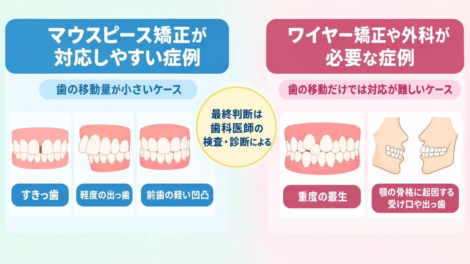 対応症例の適応範囲を示す図。左側=マウスピース矯正が対応しやすい症例(すきっ歯・軽度の出っ歯・前歯の軽い凹凸=歯の移動量が小さいケース)、右側=ワイヤー矯正や外科が必要な症例(重度の叢生・顎の骨格に起因する受け口や出っ歯)。中央に『最終判断は歯科医師の検査・診断による』の注記