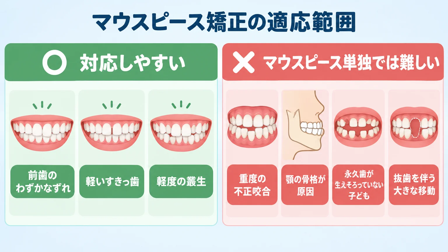 マウスピース矯正の適応範囲を示すイラスト。『対応しやすい:前歯のわずかなずれ/軽いすきっ歯/軽度の叢生』と『マウスピース単独では難しい:重度の不正咬合/顎の骨格が原因/永久歯が生えそろっていない子ども/抜歯を伴う大きな移動』を左右で対比した図