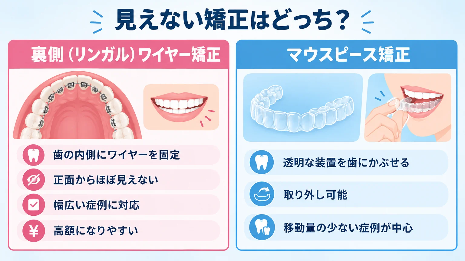 見えない矯正の2つの選択肢を比較するイラスト。左側に『裏側(リンガル)ワイヤー矯正:歯の内側にワイヤーを固定、正面からほぼ見えない、幅広い症例に対応、高額になりやすい』、右側に『マウスピース矯正:透明な装置を歯にかぶせる、取り外し可能、移動量の少ない症例が中心』を対比。中央に『見えない矯正はどっち?』の見出し