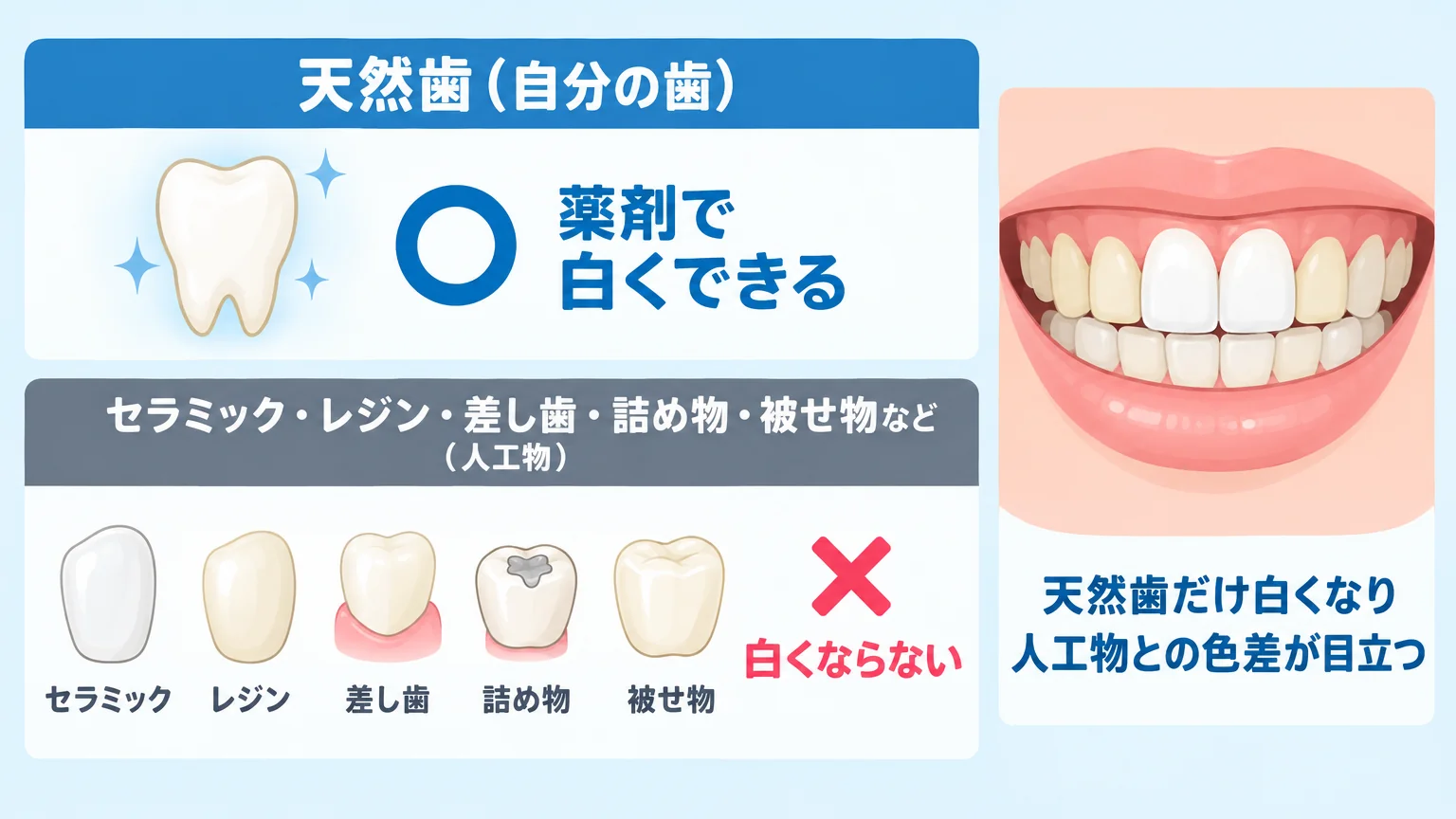 ホワイトニングで白くなる歯・ならない歯を示すイラスト。上段に天然歯（自分の歯）＝薬剤で白くできる○、下段にセラミック・レジン・差し歯・詰め物・被せ物などの人工物＝白くならない×を並べ、天然歯だけ白くなって人工物との色差が目立つ前歯の口元イメージを添える