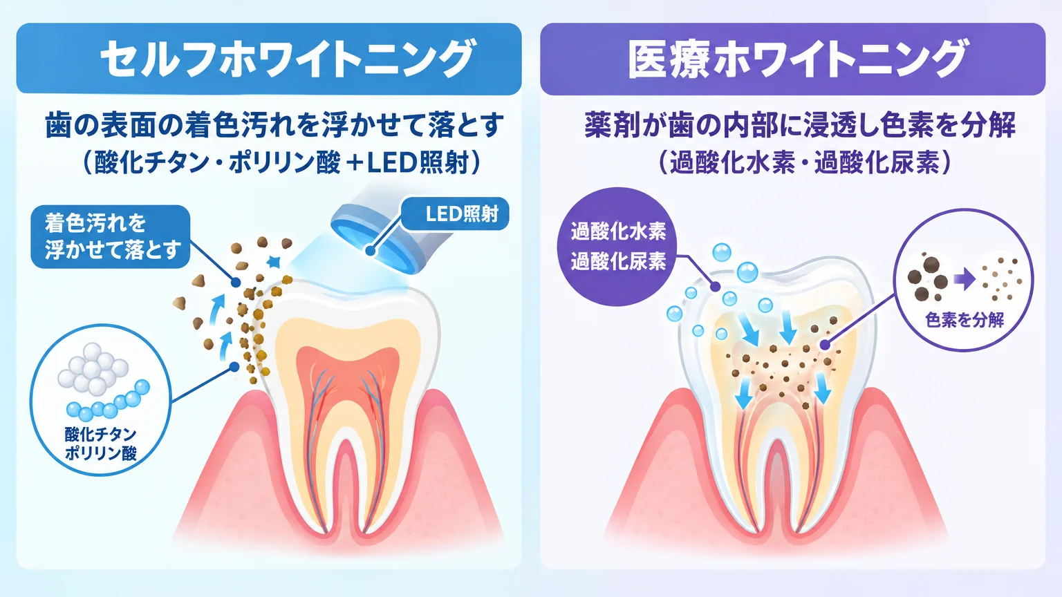セルフホワイトニングと医療ホワイトニングの作用の違いを示す図解。左側に『セルフホワイトニング＝歯の表面の着色汚れを浮かせて落とす（酸化チタン・ポリリン酸＋LED照射）』、右側に『医療ホワイトニング＝薬剤が歯の内部に浸透し色素を分解（過酸化水素・過酸化尿素）』を歯の断面イラストで対比