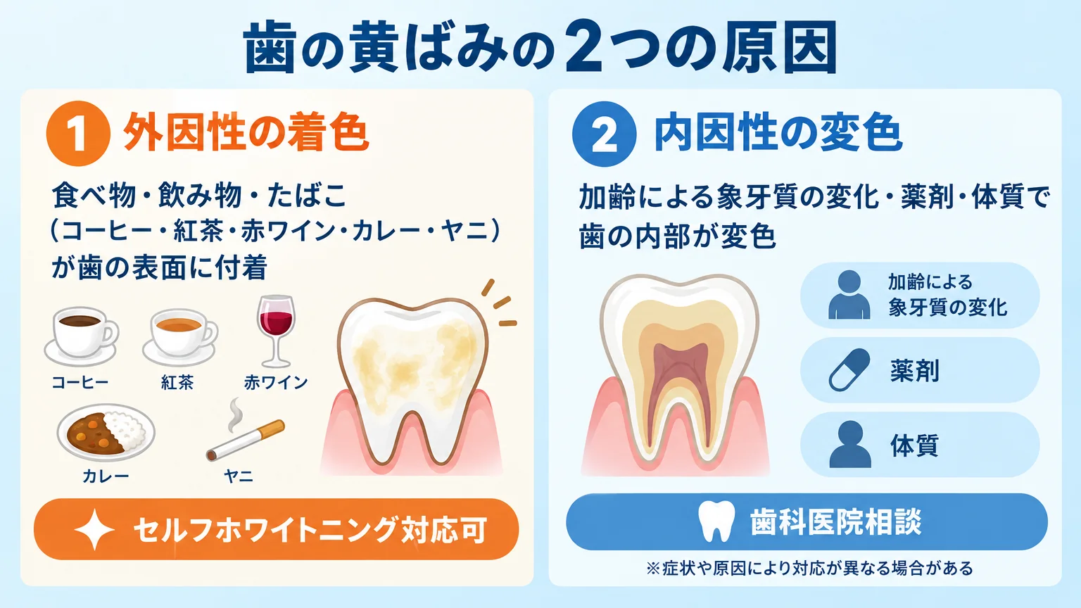 歯の黄ばみの2つの原因を示す図解。左に『外因性の着色＝食べ物・飲み物・たばこ（コーヒー・紅茶・赤ワイン・カレー・ヤニ）が歯の表面に付着』、右に『内因性の変色＝加齢による象牙質の変化・薬剤・体質で歯の内部が変色』。外因性はセルフホワイトニング対応可、内因性は歯科医院相談と注記