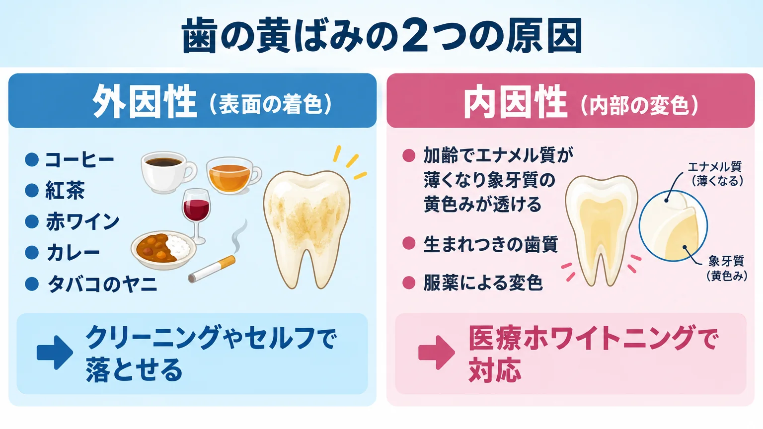 歯の黄ばみの2つの原因を対比したイラスト。左側『外因性(表面の着色):コーヒー・紅茶・赤ワイン・カレー・タバコのヤニ → クリーニングやセルフで落とせる』、右側『内因性(内部の変色):加齢でエナメル質が薄くなり象牙質の黄色みが透ける・生まれつきの歯質・服薬による変色 → 医療ホワイトニングで対応』と図示