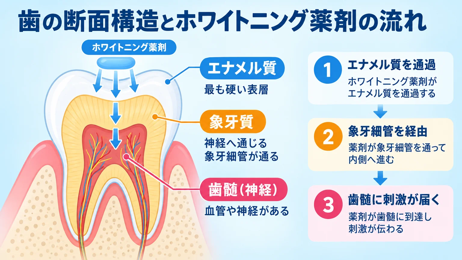歯の断面構造を示すイラスト図解。外側から順にエナメル質(最も硬い表層)、象牙質(神経へ通じる象牙細管が通る)、歯髄(神経)の3層を色分けして表示。ホワイトニング薬剤がエナメル質を通過→象牙細管を経て→歯髄に刺激が届く流れを矢印で示す