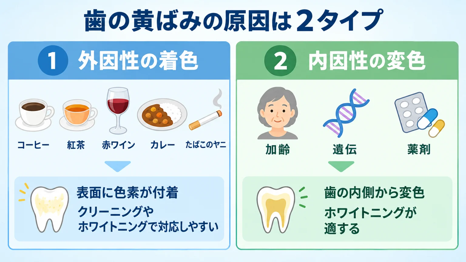歯の黄ばみの原因を2タイプに分けた比較イラスト。左『外因性の着色』にコーヒー・紅茶・赤ワイン・カレー・たばこのヤニのアイコンと『表面に色素が付着／クリーニングやホワイトニングで対応しやすい』、右『内因性の変色』に加齢・遺伝・薬剤のアイコンと『歯の内側から変色／ホワイトニングが適する』を添えた図