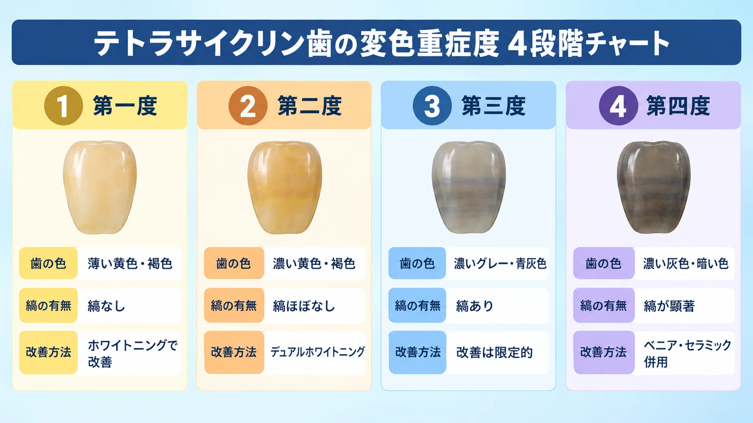テトラサイクリン歯の変色重症度4段階チャート。第一度(薄い黄色・褐色/縞なし/ホワイトニングで改善)、第二度(濃い黄色・褐色/縞ほぼなし/デュアルホワイトニング)、第三度(濃いグレー・青灰色/縞あり/改善は限定的)、第四度(濃い灰色・暗い色/縞が顕著/ベニア・セラミック併用)を歯の色見本と共に並べる