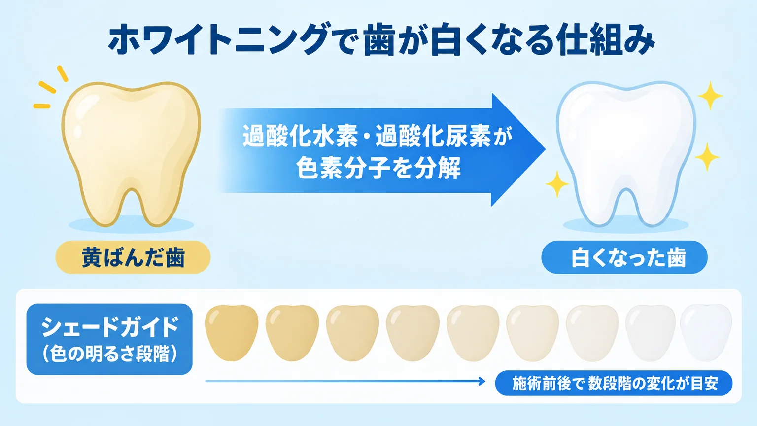 ホワイトニングで歯が白くなる仕組みの図解。左に黄ばんだ歯のイラスト、中央に『過酸化水素・過酸化尿素が色素分子を分解』の矢印、右に明るくなった歯のイラスト。下部にシェードガイド（色の明るさ段階を示す色見本バー）を配置し『施術前後で数段階の変化が目安』と注記