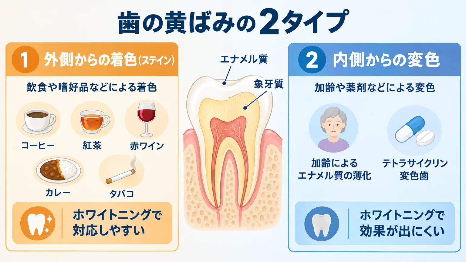 歯の黄ばみの2タイプ比較インフォグラフィック。左側『外側からの着色（ステイン）』=コーヒー・紅茶・赤ワイン・カレー・タバコのアイコン、ホワイトニングで対応しやすい。右側『内側からの変色』=加齢によるエナメル質の薄化・テトラサイクリン変色歯、ホワイトニングで効果が出にくい。中央に歯の断面図（エナメル質と象牙質）
