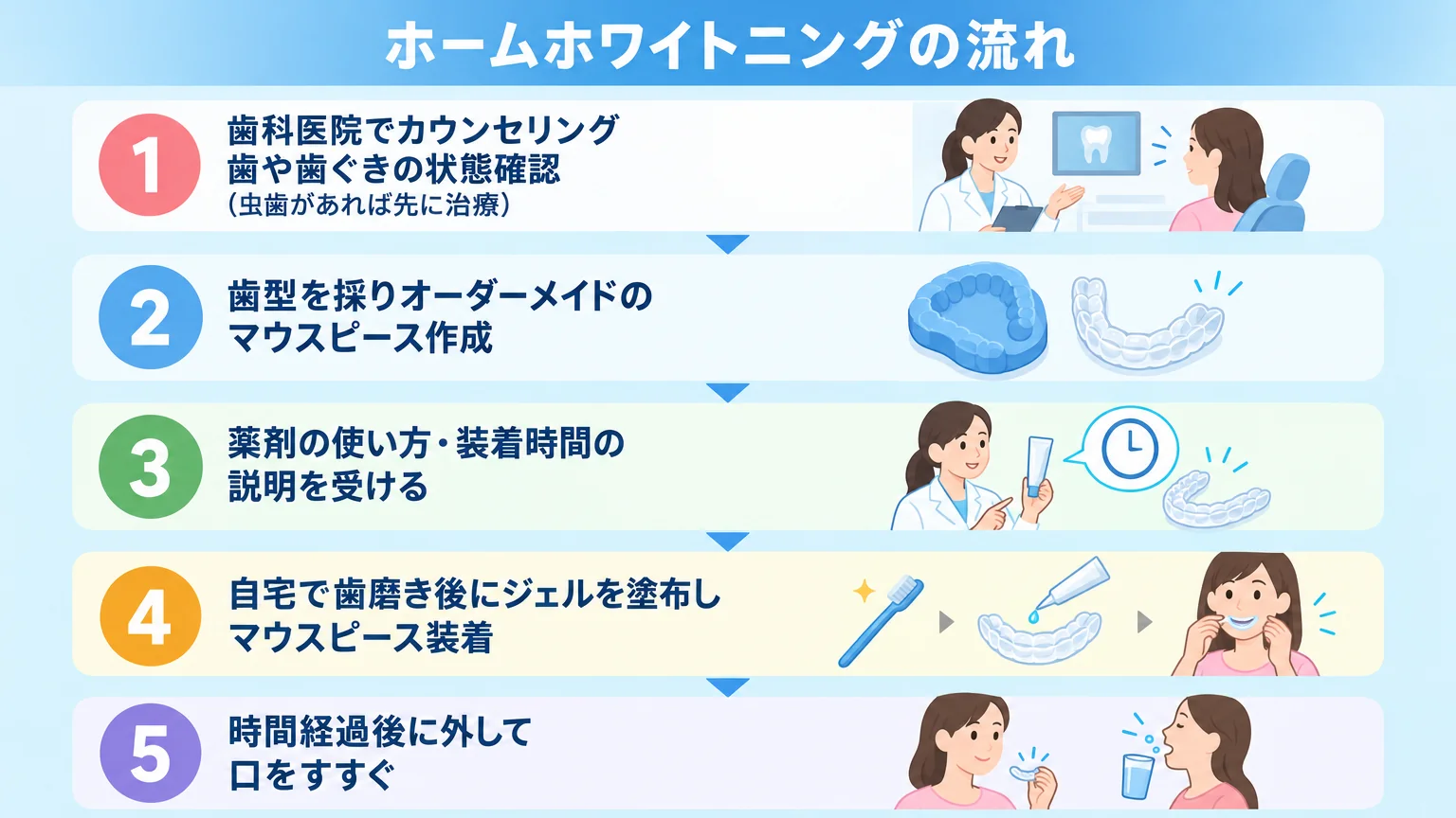 ホームホワイトニングの流れを示すフロー図。①歯科医院でカウンセリング・歯や歯ぐきの状態確認（虫歯があれば先に治療）→②歯型を採りオーダーメイドのマウスピース作成→③薬剤の使い方・装着時間の説明を受ける→④自宅で歯磨き後にジェルを塗布しマウスピース装着→⑤時間経過後に外して口をすすぐ、の5ステップ縦型フロー