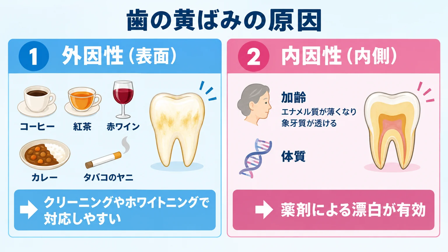 歯の黄ばみの原因を2タイプに分けて対比するイラスト図。左『外因性（表面）：コーヒー・紅茶・赤ワイン・カレー・タバコのヤニ→クリーニングやホワイトニングで対応しやすい』、右『内因性（内側）：加齢でエナメル質が薄くなり象牙質が透ける・体質→薬剤による漂白が有効』の2カラム構成