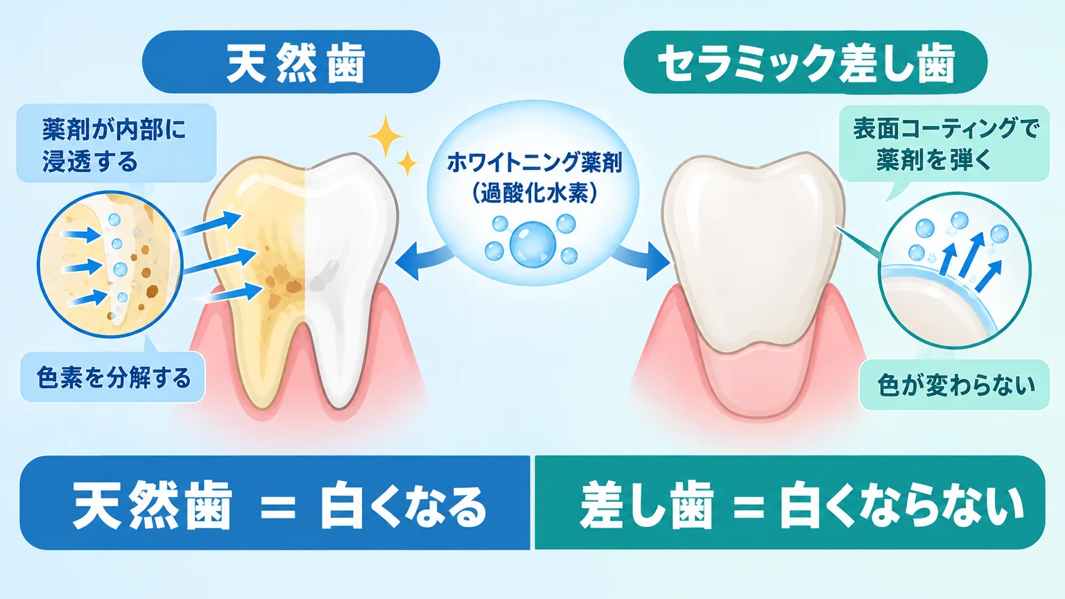 差し歯と天然歯の違いを示すイラスト。左側に天然歯(薬剤が内部に浸透し色素を分解する様子を矢印で表現・白くなる)、右側にセラミック差し歯(表面コーティングで薬剤が弾かれる様子・色が変わらない)。中央に『ホワイトニング薬剤(過酸化水素)』のラベル。下部に『天然歯=白くなる/差し歯=白くならない』の対比テキスト