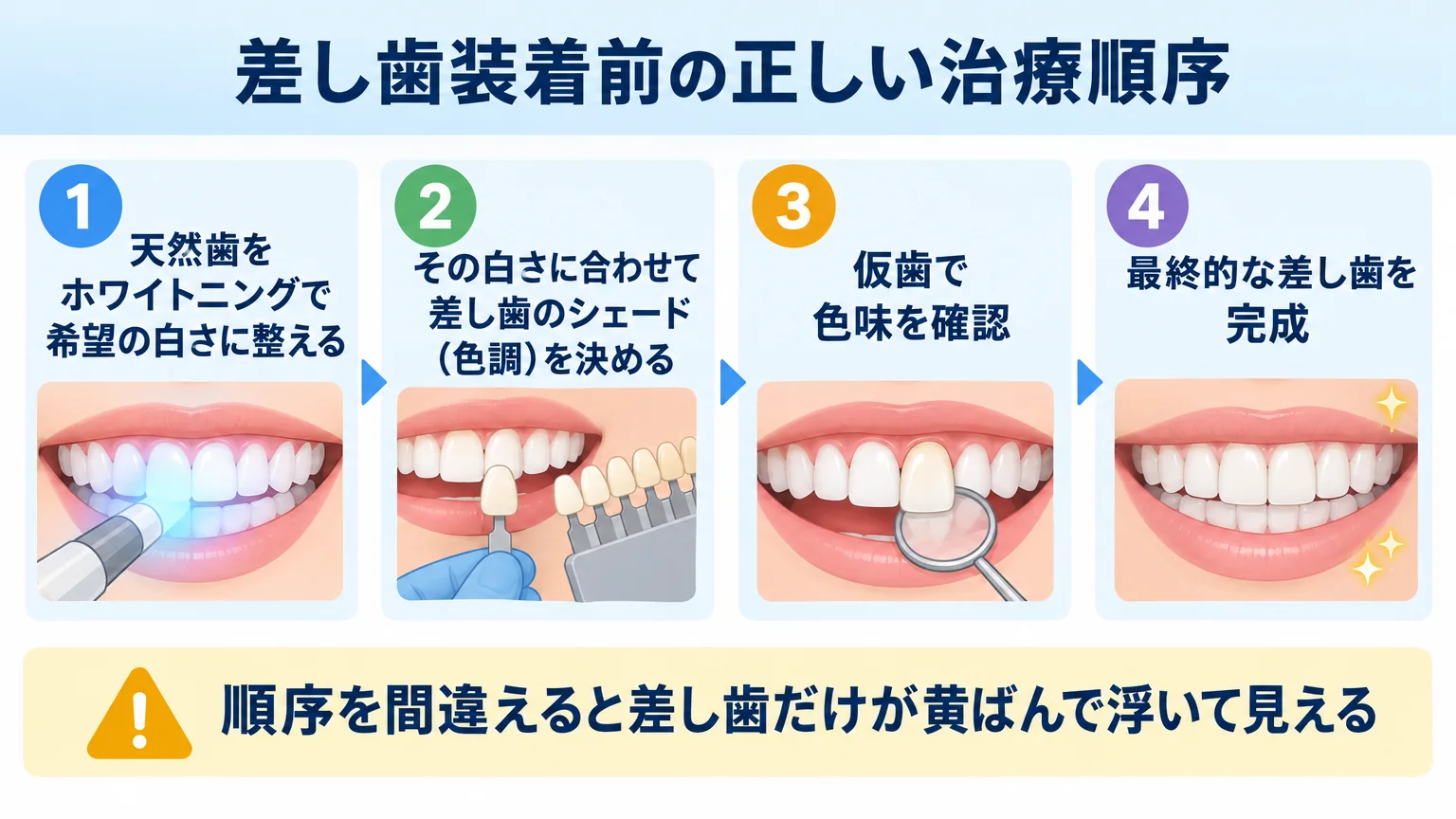 差し歯装着前の正しい治療順序を示すフロー図。ステップ①天然歯をホワイトニングで希望の白さに整える→ステップ②その白さに合わせて差し歯のシェード(色調)を決める→ステップ③仮歯で色味を確認→ステップ④最終的な差し歯を完成。下部に『順序を間違えると差し歯だけが黄ばんで浮いて見える』の注意書き
