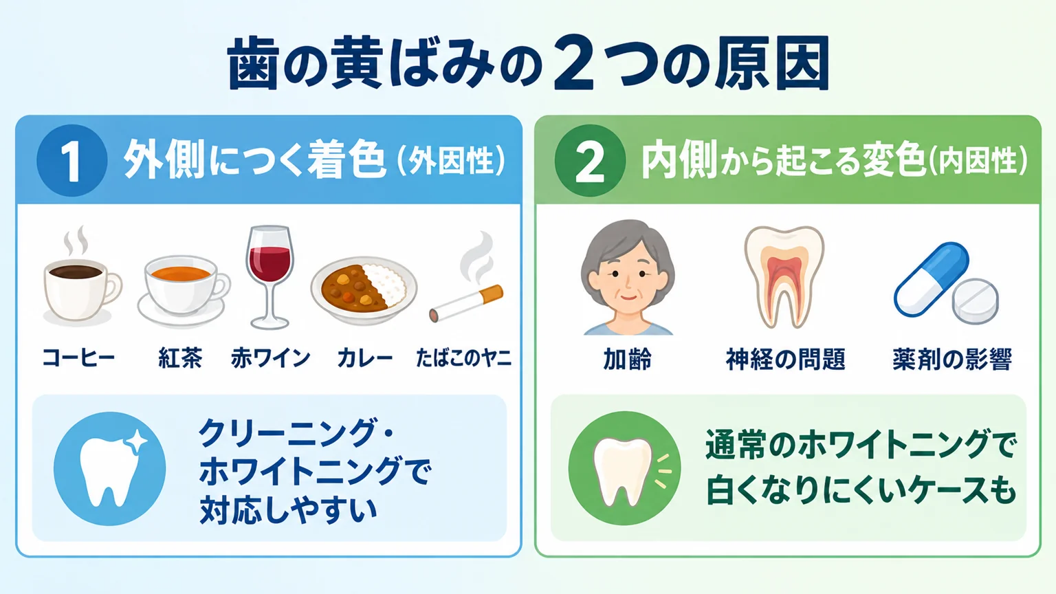 歯の黄ばみの2つの原因を示すインフォグラフィック。左に『外側につく着色(外因性)』としてコーヒー・紅茶・赤ワイン・カレー・たばこのヤニのアイコンと『クリーニング・ホワイトニングで対応しやすい』、右に『内側から起こる変色(内因性)』として加齢・神経の問題・薬剤の影響のアイコンと『通常のホワイトニングで白くなりにくいケースも』の注記を配置