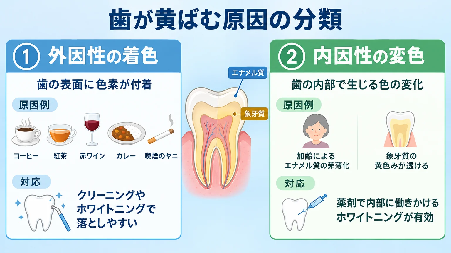 歯が黄ばむ原因の分類イラスト。2つに大別。左『外因性の着色』=歯の表面に色素が付着/原因例:コーヒー・紅茶・赤ワイン・カレー・喫煙のヤニ/対応:クリーニングやホワイトニングで落としやすい。右『内因性の変色』=歯の内部で生じる色の変化/原因例:加齢によるエナメル質の菲薄化・象牙質の黄色みが透ける/対応:薬剤で内部に働きかけるホワイトニングが有効。歯の断面図でエナメル質と象牙質を示す