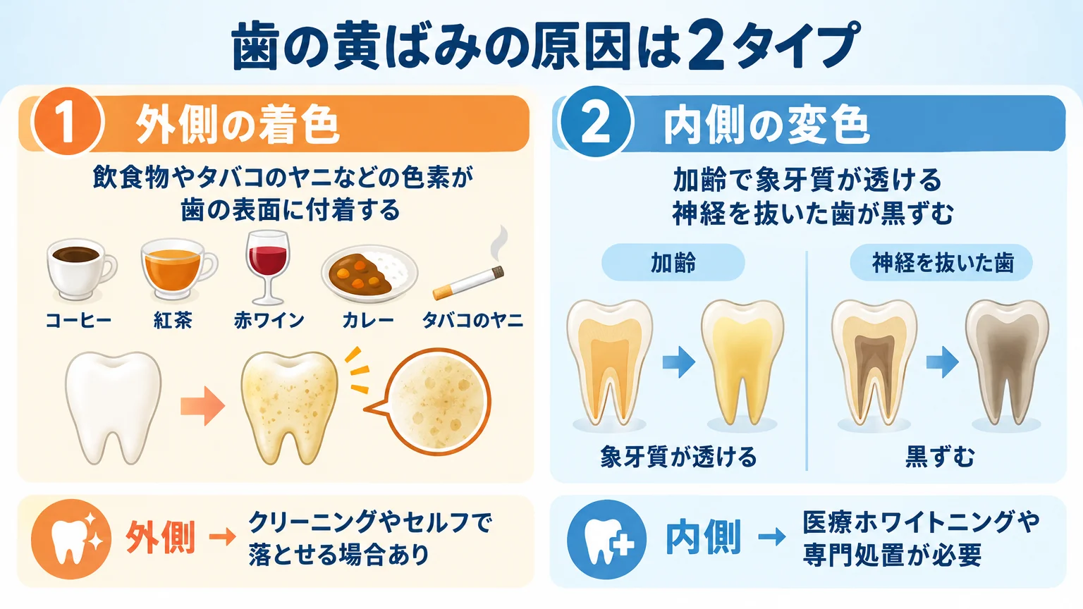 歯の黄ばみの原因を2タイプで対比したインフォグラフィック。左『外側の着色』=コーヒー・紅茶・赤ワイン・カレー・タバコのヤニのアイコン＋歯の表面に色素が付着するイメージ。右『内側の変色』=加齢で象牙質が透ける・神経を抜いた歯が黒ずむイメージ。下部に『外側→クリーニングやセルフで落とせる場合あり／内側→医療ホワイトニングや専門処置が必要』と対処法を併記。