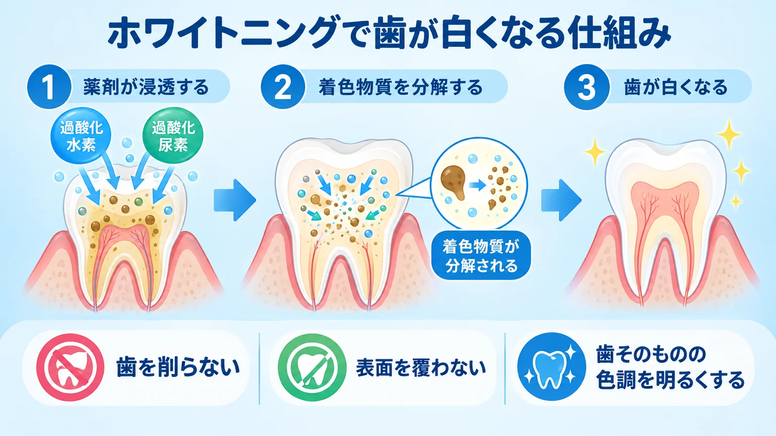ホワイトニングで歯が白くなる仕組みを示すインフォグラフィック。歯の断面図を使い、過酸化水素・過酸化尿素の薬剤が歯の内部の着色物質に作用して分解するプロセスを矢印で示す。「歯を削らない」「表面を覆わない」「歯そのものの色調を明るくする」の3点を併記