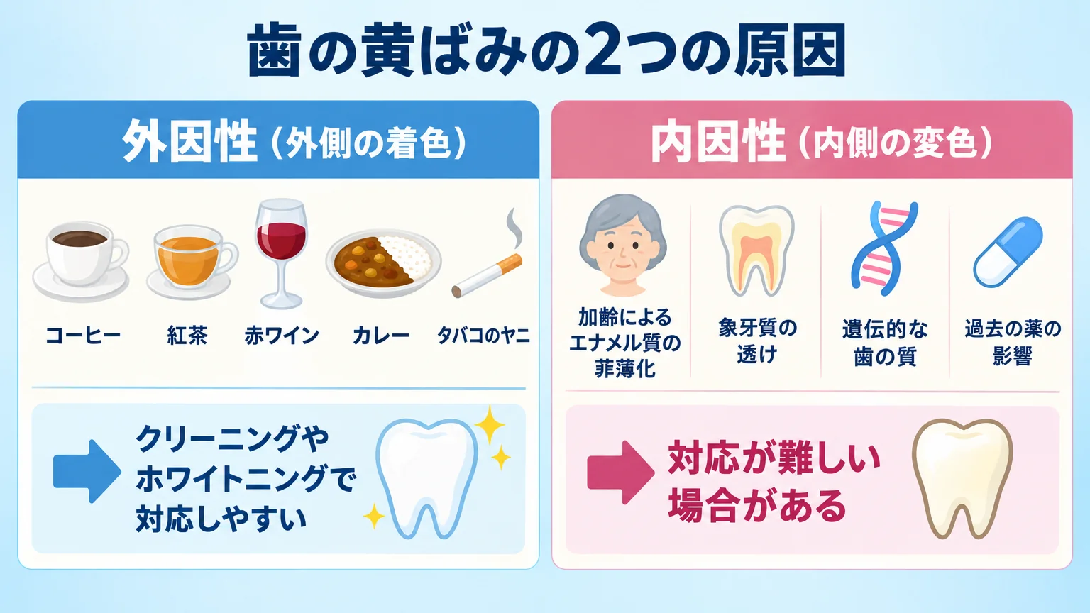 歯の黄ばみの2つの原因を分類した概念図。左=外因性(外側の着色):コーヒー・紅茶・赤ワイン・カレー・タバコのヤニ→クリーニングやホワイトニングで対応しやすい。右=内因性(内側の変色):加齢によるエナメル質の菲薄化・象牙質の透け・遺伝的な歯の質・過去の薬の影響→対応が難しい場合がある
