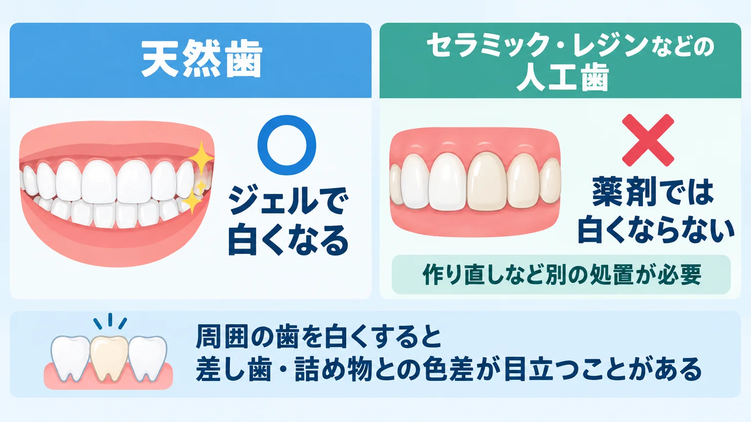 天然歯と人工歯のホワイトニング可否を示すイラスト。左に『天然歯＝ジェルで白くなる（○）』、右に『セラミック・レジンなどの人工歯＝薬剤では白くならない（×）』を並べ、人工歯は作り直しなど別処置が必要と注記する。下部に『周囲の歯を白くすると差し歯・詰め物との色差が目立つことがある』と補足
