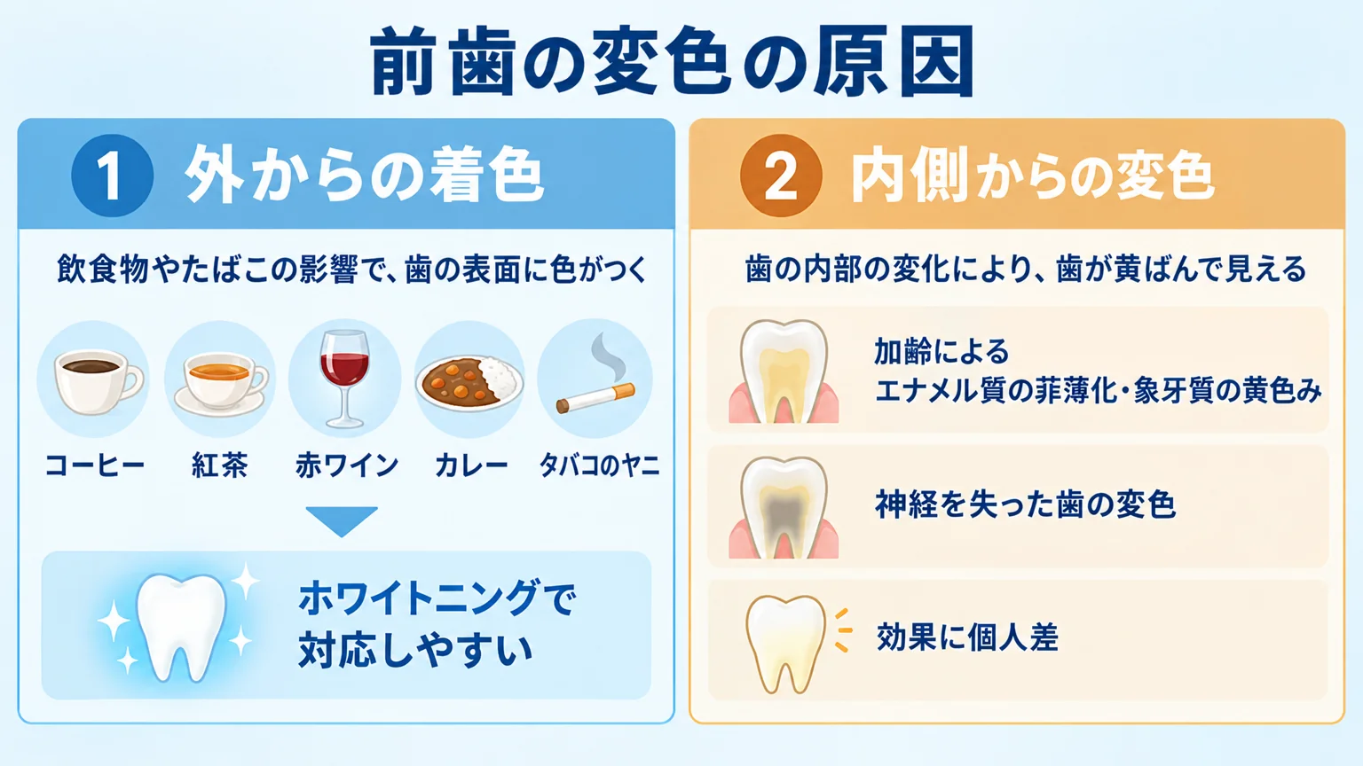 前歯の変色の原因を2分類で示すイラスト図。左=外からの着色（コーヒー・紅茶・赤ワイン・カレー・タバコのヤニ、ホワイトニングで対応しやすい）、右=内側からの変色（加齢によるエナメル質の菲薄化・象牙質の黄色み、神経を失った歯の変色、効果に個人差）
