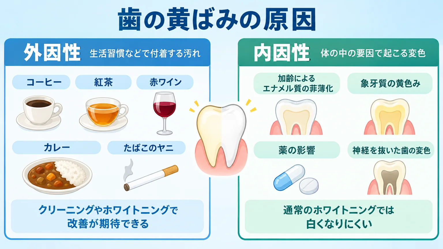 歯の黄ばみの原因を外因性と内因性に分けて整理したイラスト。外因性=コーヒー・紅茶・赤ワイン・カレー・たばこのヤニ（クリーニングやホワイトニングで改善が期待できる）、内因性=加齢によるエナメル質の菲薄化・象牙質の黄色み・薬の影響・神経を抜いた歯の変色（通常のホワイトニングでは白くなりにくい）を左右2カラムで対比